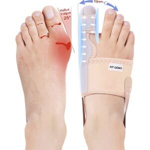 2-pcs  Orthopedic Hallux Valgus Toe Spacer – Adjustable Day & Night Bunion Re...